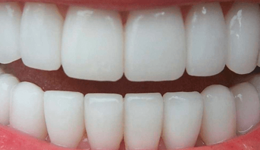 Замена коронки зуба